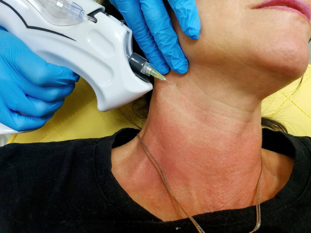 Neck,Rejuvenation,With,Carbon,Dioxide,,Carboxytherapy,,Getting,Rid,Of,Wrinkles